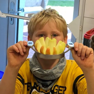 Ein Junge hält einen mehrfach geteilten Apfel in die Kamera